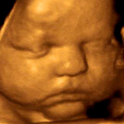 3D Ultrasound Center Of Orlando By Prenatal Impressions Orlando (407)521-8390